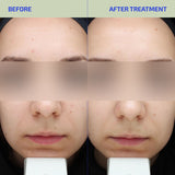 Jabón exfoliante Bia 2.0