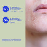 Jabón exfoliante Bia 2.0