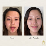 Suero botánico Clarify