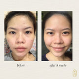 Suero botánico Clarify